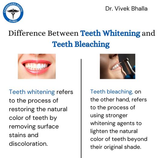 Top-Notch Dental Care at Chandigarh Dental Clinic - Book Your Appointment Today - Doctors in India