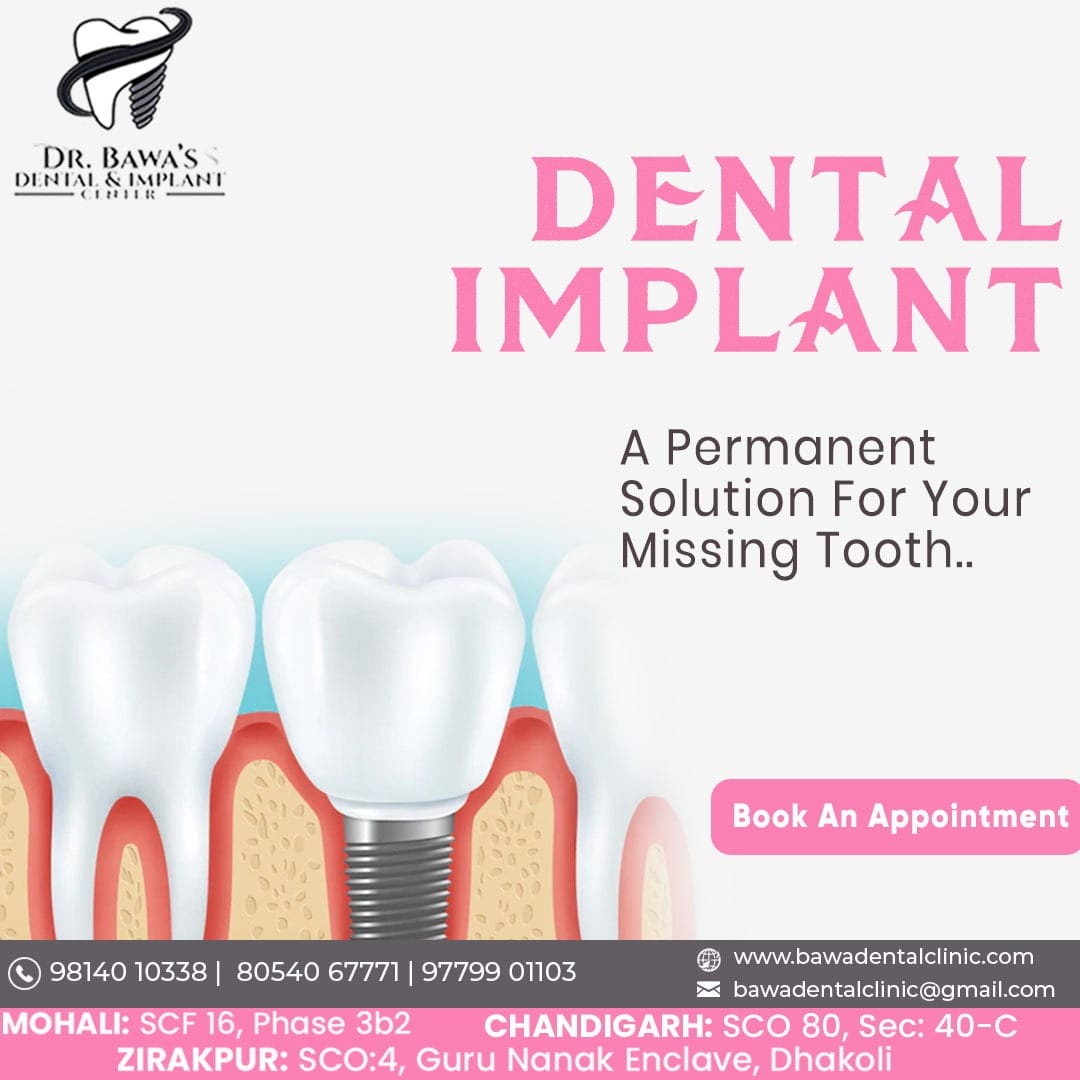 Transform Your Smile Today – Book Your Appointment at Bawa Dental & Implant Centre! - Doctors in India